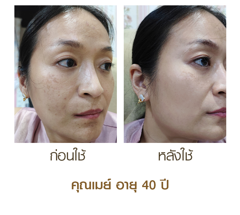 Goldila-CN211203-18