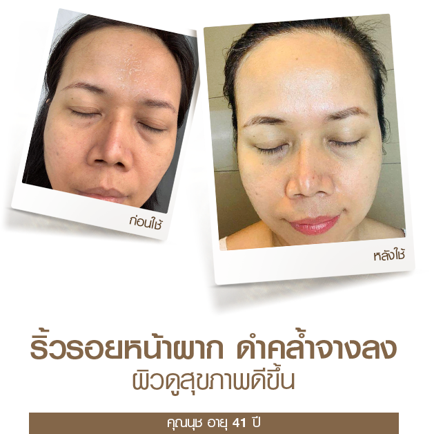 moveimage 29