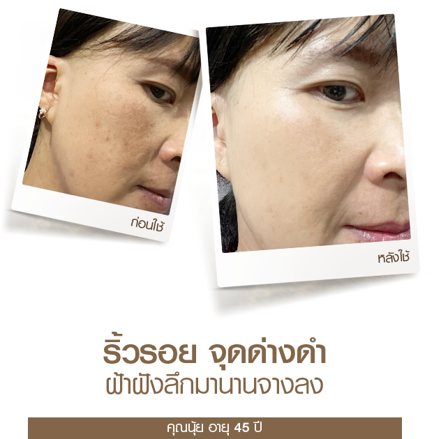 moveimage 30