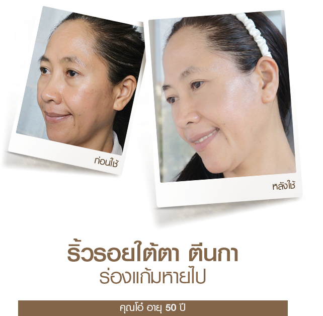 moveimage 31