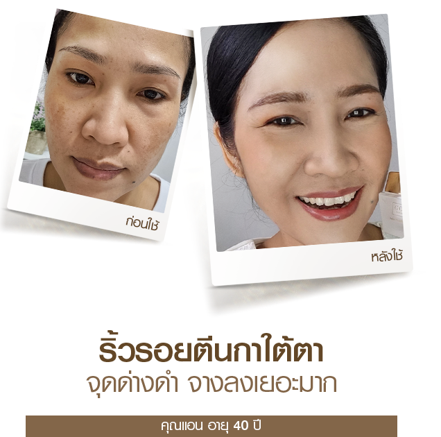 moveimage 40